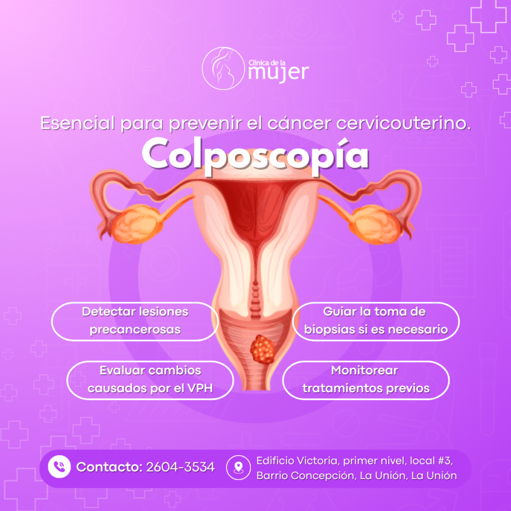 Colposcopía