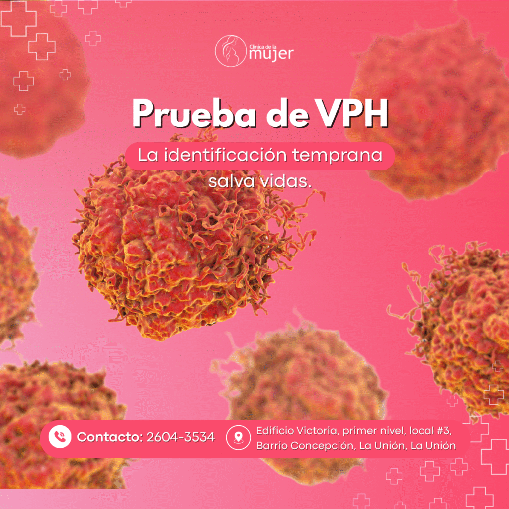 vph